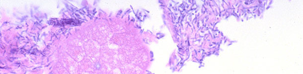 Small intestine of a piglet with diarrhea associated with Clostridium perfringens type A infection
