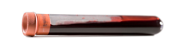 Okres czasu uzyskania PRRSV ujemnych prosiąt w stadach loch PRRS dodatnich