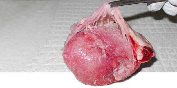 Serce, zapalenei osierdzia obserwowane w uogólnionym zakażeniu M. hyorhinis