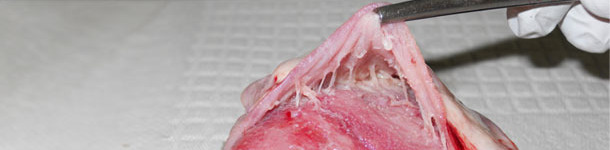 Serce, zapalenei osierdzia obserwowane w uogólnionym zakażeniu M. hyorhinis