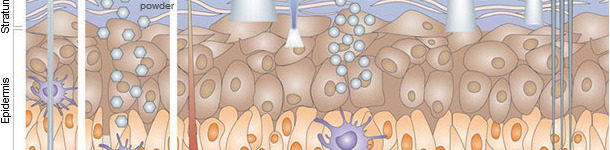 Immunization by cutaneous routes.
