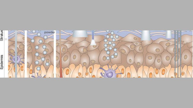 Immunization by cutaneous routes.