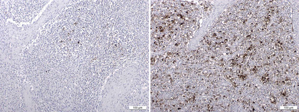 Antygen PCV2 wykryty w wyniku badania immunohistochemicznego