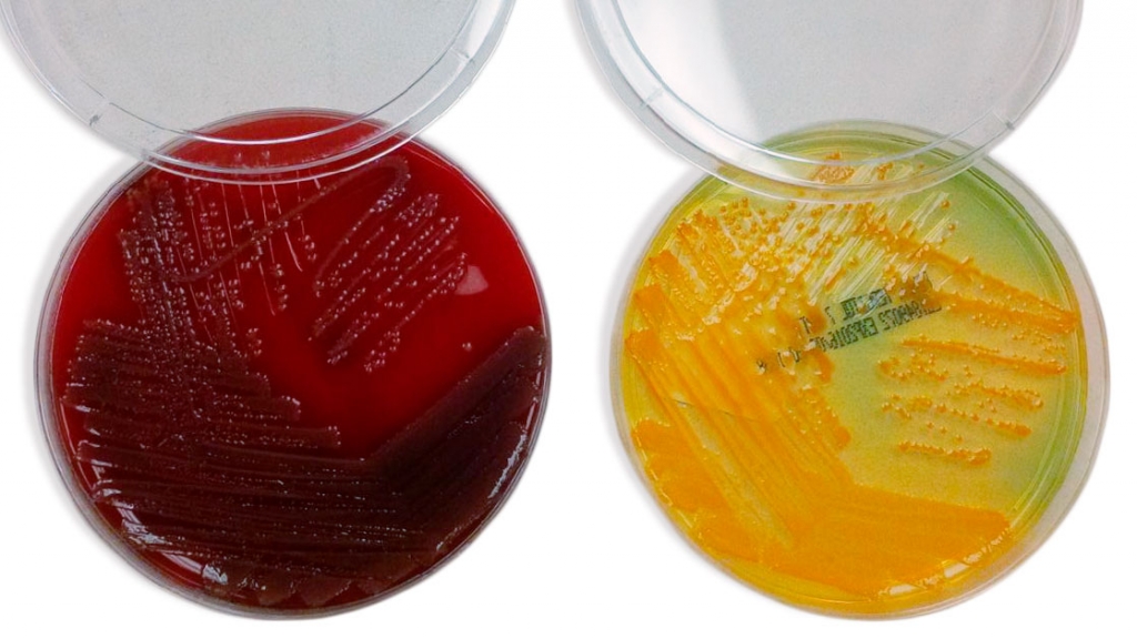 Wzrost bakterii na podłożach różnicujących, rozpoznawanie E. coli.