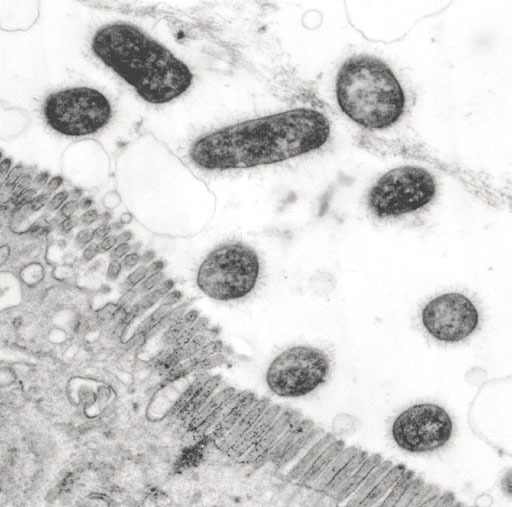 Bakterie ETEC posiadają podobne do włos&oacute;w adhezyny fimbrialne na swojej powierzchni i dzięki nim przylegają do kom&oacute;rek nabłonkowych jelita u świń z biegunką, co wykazano w badaniach przeprowadzonych w mikroskopie elektronowym
