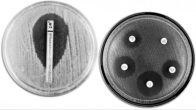 Klasyczne techniki oceny oporności na antybiotyki. Zdjęcie pokazuje E-TEST po lewej stronie, w celu pomiaru minimalnego stężenie antybiotyku zapobiegającego rozwojowi bakterii. Prawa strona pokazuje test wrażliwości na środki przeciwdrobnoustrojowe z r&oacute;żnymi strefami zahamowania wzrostu bakterii wobec r&oacute;żnych antybiotyk&oacute;w.
