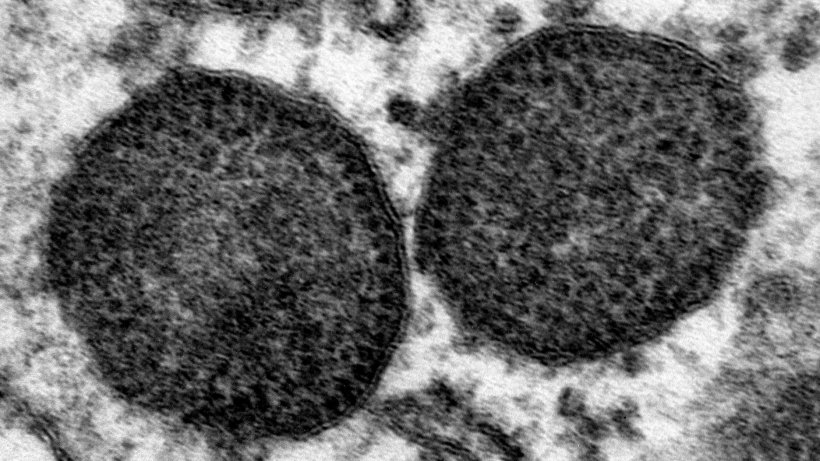Mikroskopia elektronowa dw&oacute;ch ciał inkluzyjnych w cytoplazmie makrofag&oacute;w, w tym bardzo dużej liczby cząstek PCV2. 150.000x. Źr&oacute;dło: Carolina Rodr&iacute;guez-Cari&ntilde;o, CReSA
