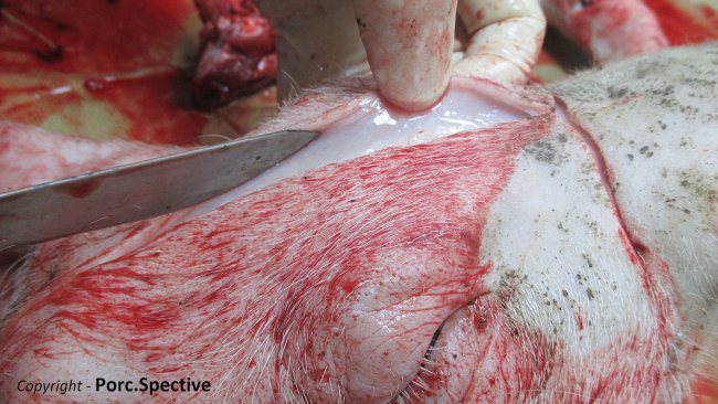 Fot 1. Obrzęk tkanki podskórnej skóry głowy