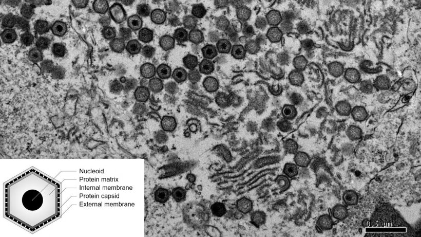 Obraz z mikroskopu elektronowego kom&oacute;rki zainfekowanej wirusem ASF.
