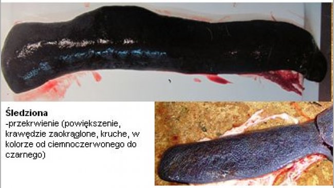 Spleen