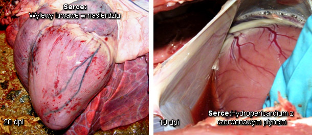 Hydrothorax 