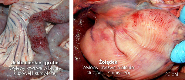 Stomach and Small and large intestine