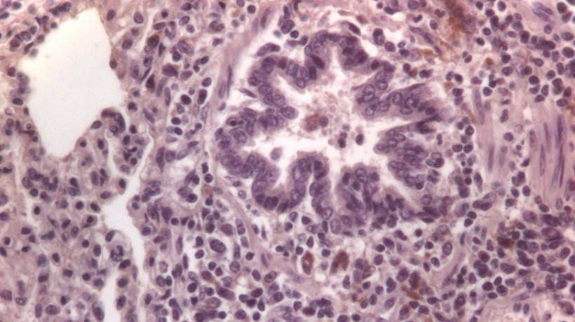 Rycina 3: Kom&oacute;rki znakowane immunologicznie na PCV2 w płucach
