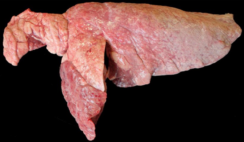 Ryc 6. Koinfekcja M. hyopneumoniae i P. multocida w płucach świń. Obszary czerwono-brązowej konsolidacji czaszkowo-brzusznej, uniesione w stosunku do pozostałej części miąższu płuc, są zgodne z obrazem&nbsp;zmian&nbsp;wywołanych&nbsp;przez P. multocida. W płacie czaszkowym i obrzeżach czaszkowo-brzusznych płata ogonowego znajdują się czerwonawe zagłębienia konsolidacji, kt&oacute;re odpowiadają zmianom wywołanym przez M. hyopneumoniae.
