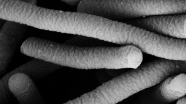 Fot. 1. Mikrografia elektronowa Lactobacillus acidophilus, która ma właściwości probiotyczne. Zdjęcie od Mogana Das Murtey i Patchamuthu Ramasamy.