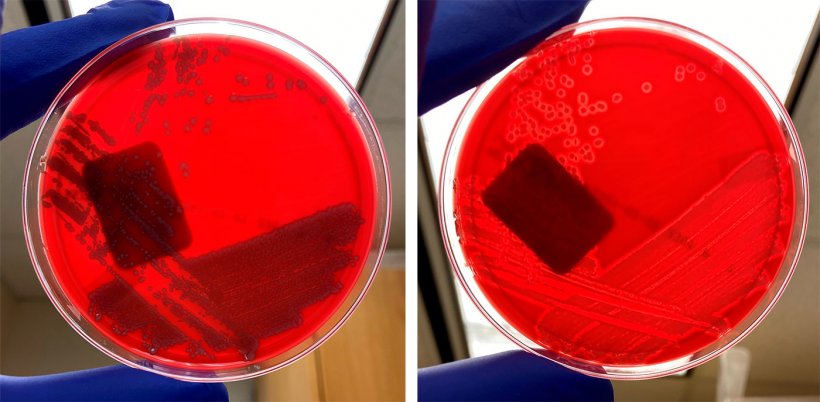 Niehemolityczne szczepy&nbsp;E coli (po lewej) i hemolityczne szczepy&nbsp;E coli (po prawej).
