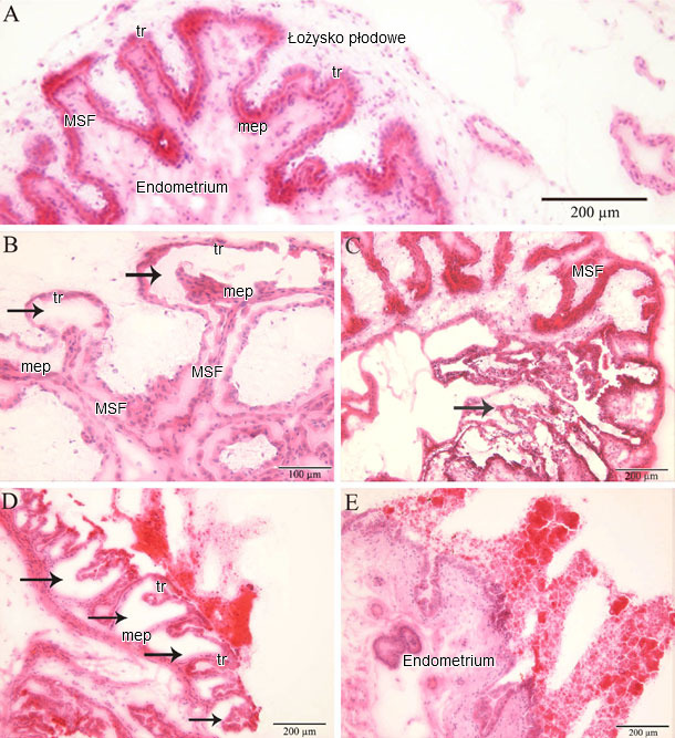 Obraz mikroskopowy endometrium i łożyska