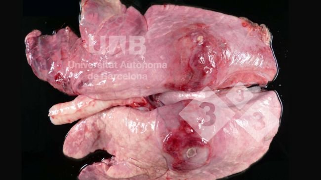 Fot. 1. Włóknikowo - martwicze zapalenie płuc odpowiadające  zmianom wywoływanym przez App. Źródło: UAB.