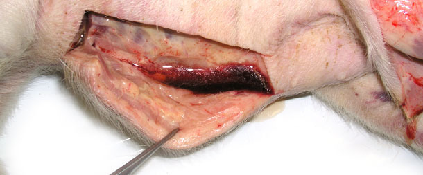 Swelling of the subcutaneous tissue, a large amount of fluid egressing after incision of skin in the lower part of the body