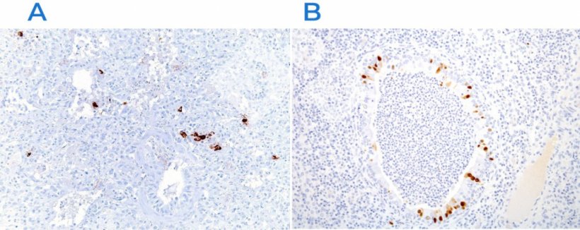 Ryc. 3. Barwienie immunohistochemiczne w celu wykrycia wirusa zespołu rozrodczo-oddechowego świń (PRRSV) (A) i wirusa grypy świń (B). Należy zauważyć, że obecność antygenu wirusowego (brązowe zabarwienie) występuje w uszkodzonych obszarach.