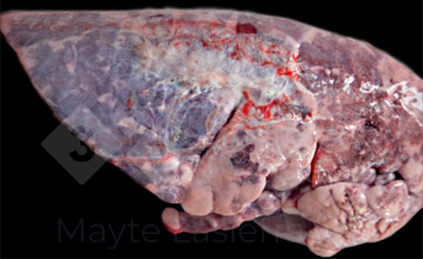 <p>Zapalenie opłucnej dogrzbietowo-doogonowej</p>
