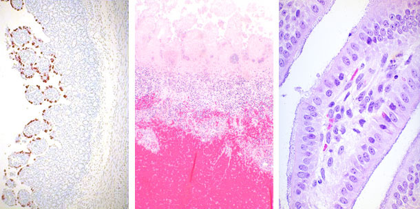 Rotavirus, E.coli i Clostridium perfringens