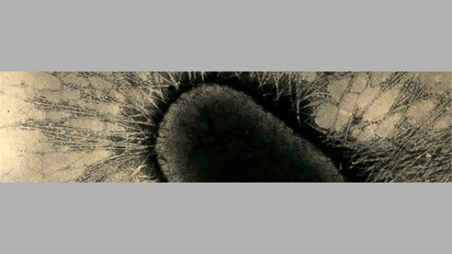 fimbrie lub białkowych pile E. coli mocno przyczepiają się do receptorów glikoproteinowych enterocytów.