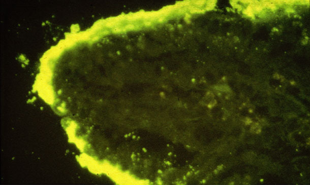 Gęsto przyczepione kolonie E. coli do kosmka jelitowego (IFA).