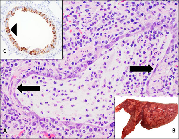 Samples collected for influenza detection