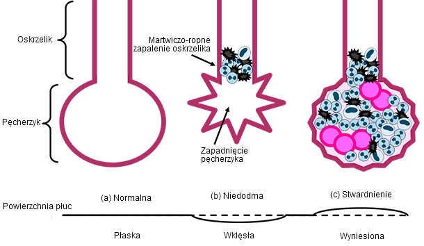 Bronchiolae