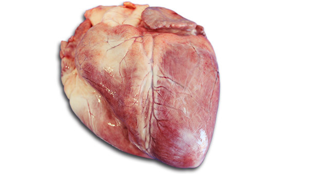 Focal brightened alterations of the myocardium