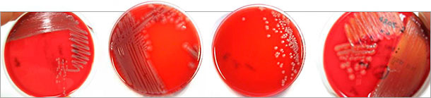 Morfologia różnych kolonii patogennych izolatów E.coli 