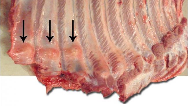 Widoczne liczne złamania żeber w częściach dystalnych, z uformowaną kostniną (strzałki).