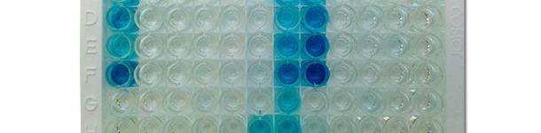hotography of IDEXX ELISA X3 plate showing positive (blue color) and negative (no color) results
